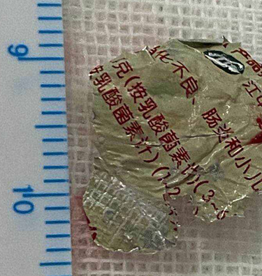 |险！武汉一岁半儿童食道发现“小儿”字样不明物