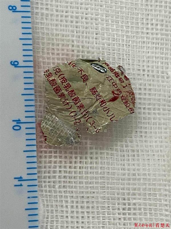|吸入南瓜子，吞进药品袋，两枚异物“卡住”一岁半小儿的呼吸