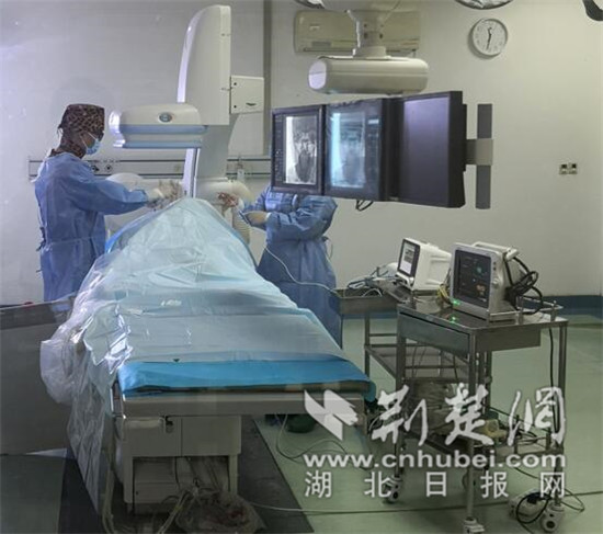 |眼周8级疼痛困扰女子10余年面部介入治疗将痛感降至2级