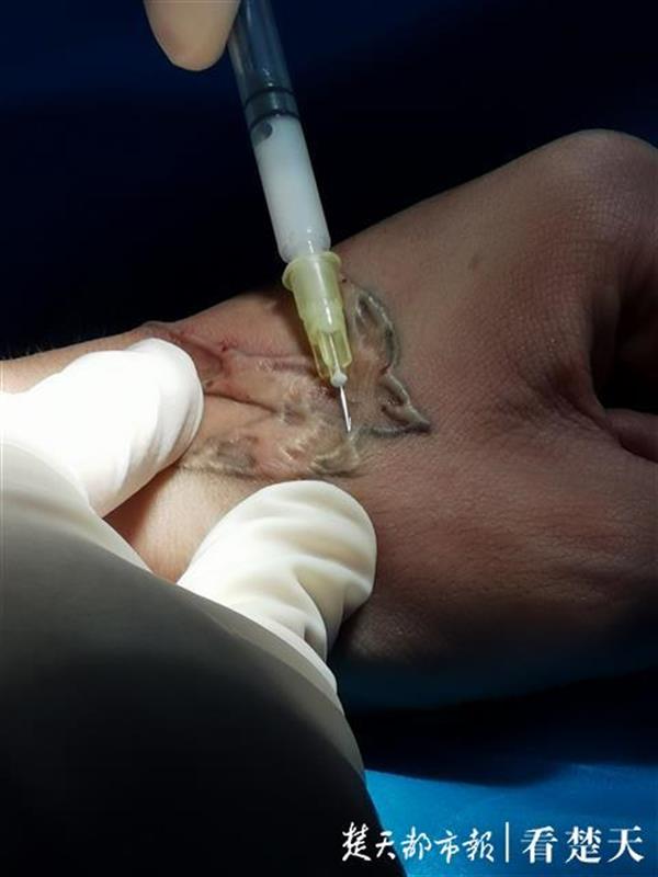 |想纹只凤凰却出来只燕子，一通操作后还落下一片疤痕