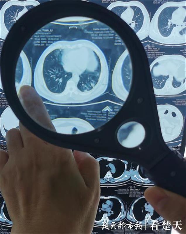 |长跑达人跑不动了、英勇民警莫名胸闷，原来他们都“栽”在了受伤的血管上