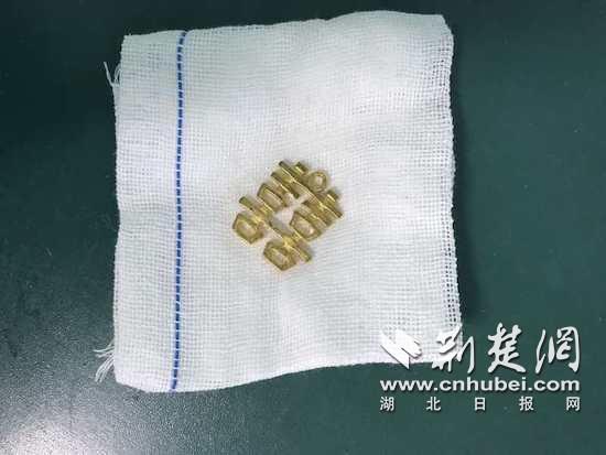|现实版“吞金兽”！一不留神9个月大婴儿吞下金吊坠