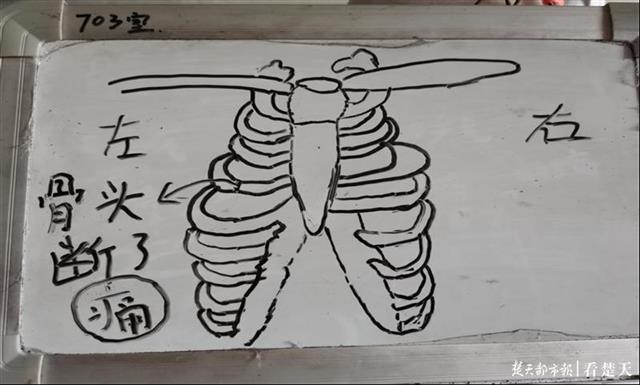 |医护与聋哑患者“传纸条”，“谢谢你，你很棒”，小画板上的出院留言超暖心