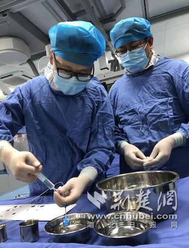 |4小时内，4名幼儿微创治愈“心病”