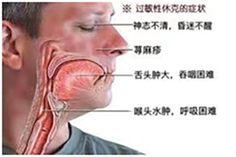 |【药师说健康】过敏那些事, 你了解多少? 系列二