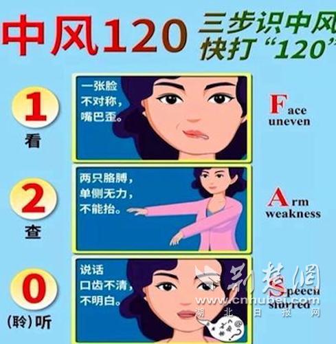 |“中风120”帮助婆婆快速识别脑卒中 抓住黄金4.5小时成功脱险