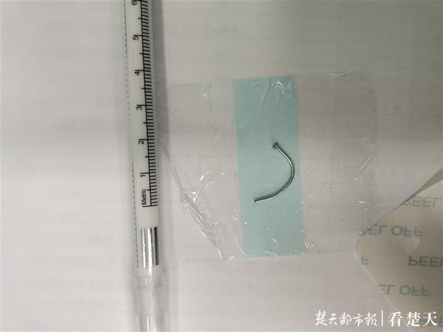 |黄陂小伙自己动手装修新房，不慎将3厘米铁钉扎入右眼致盲