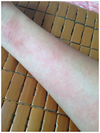 |【药师说健康】过敏那些事, 你了解多少? 系列二