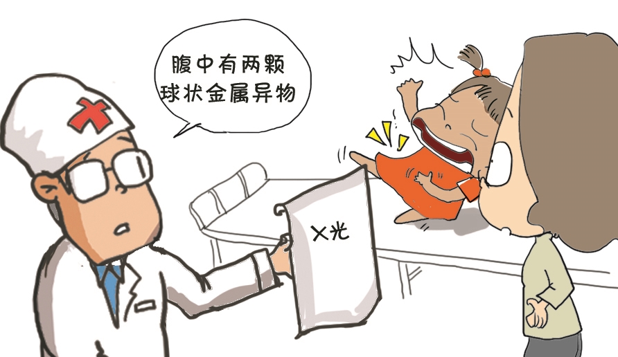 |误吞巴克球七个娃接连进手术室 专家呼吁，家长应加强4岁以下儿童看护