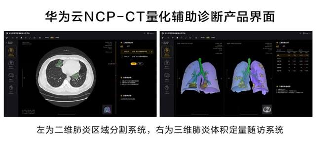 |高校团队新冠研发肺炎AI辅助诊断技术，获双创大赛金奖