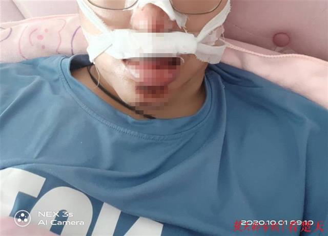 |上班路上井盖突然歪斜，骑车男子摔伤，事发10多天无人担责