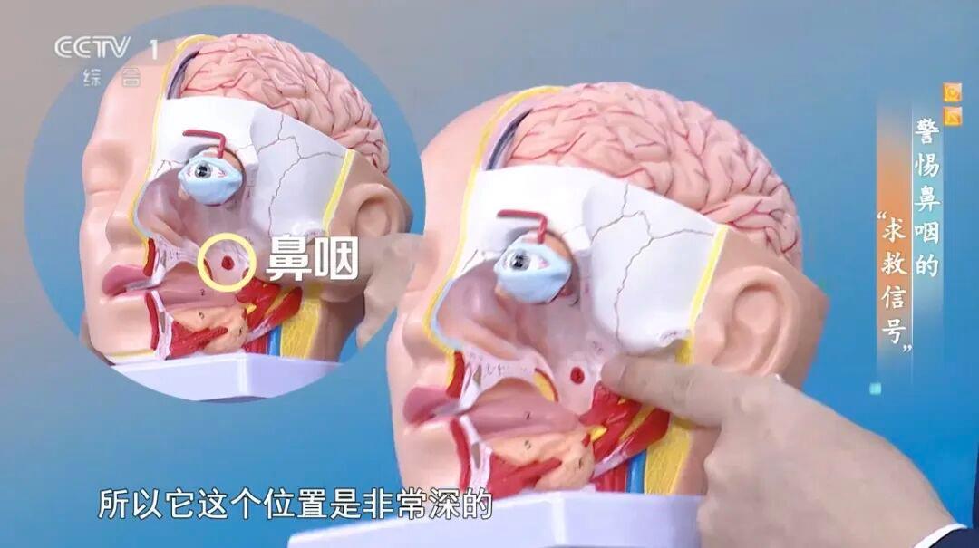 晨起后第一口痰中有血丝别大意！