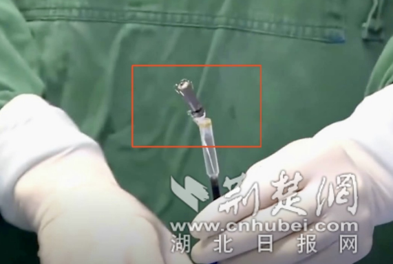 93岁老人心跳过缓晕倒家中  植入一粒“胶囊”重启生命律动