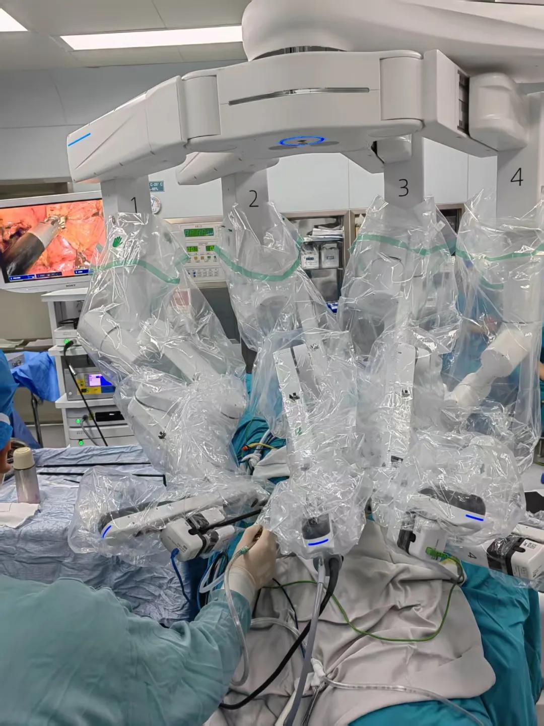 保肾又除瘤！潜江市中心医院机器人辅助肾部分切除术造福患者