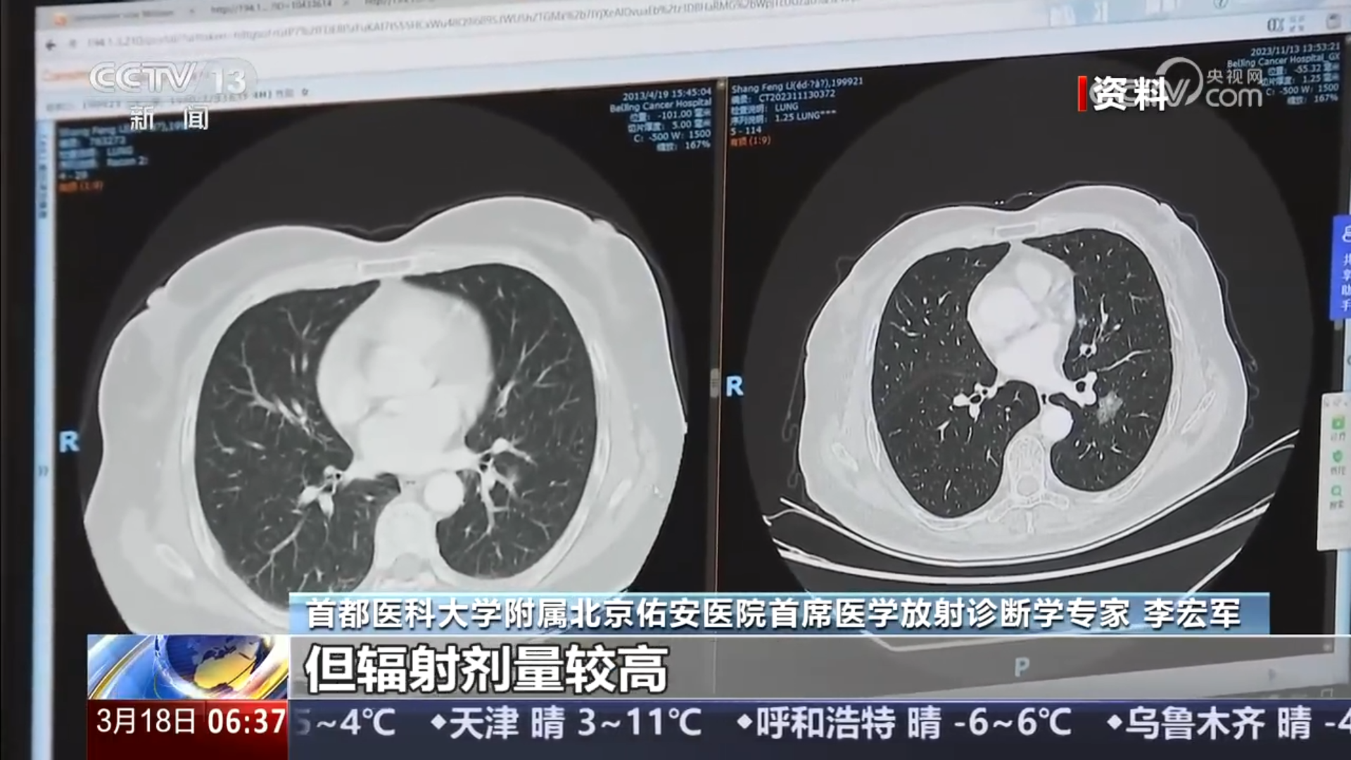 一次X光相当于10天自然背景辐射