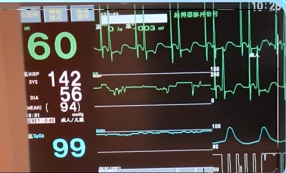 普通人不要盲目跟风打降脂针